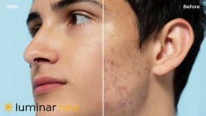 Luminar Neo Spring Upgrade Brings Smarter Portrait Editing + Extra 10% Off