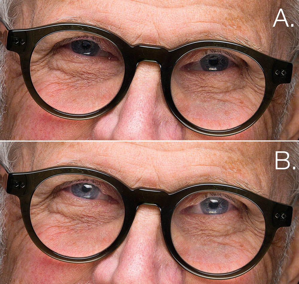 catchlight before and after